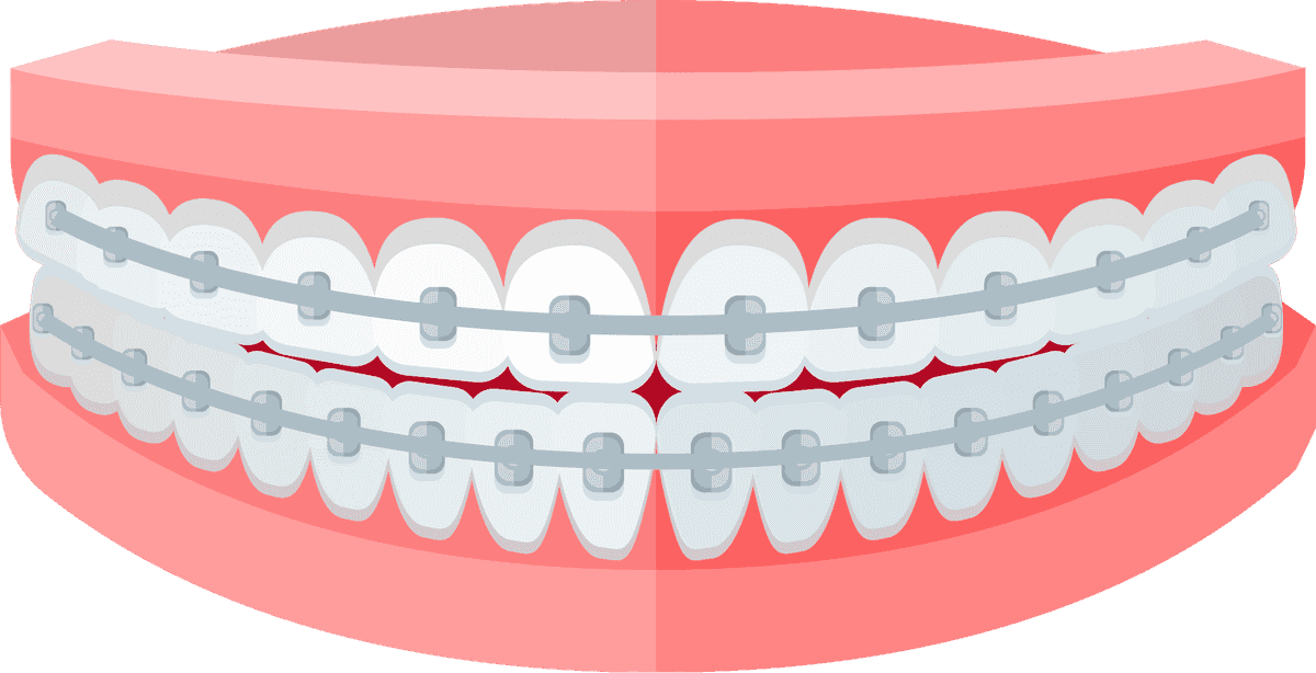 dentist isolated flat icons: orthodontic braces for effective dental care and treatment