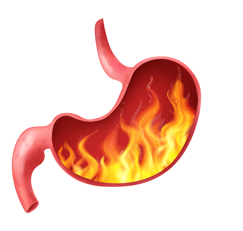 heartburn realistic human internal organ stomach icon set pyrosis fire disorder gastric