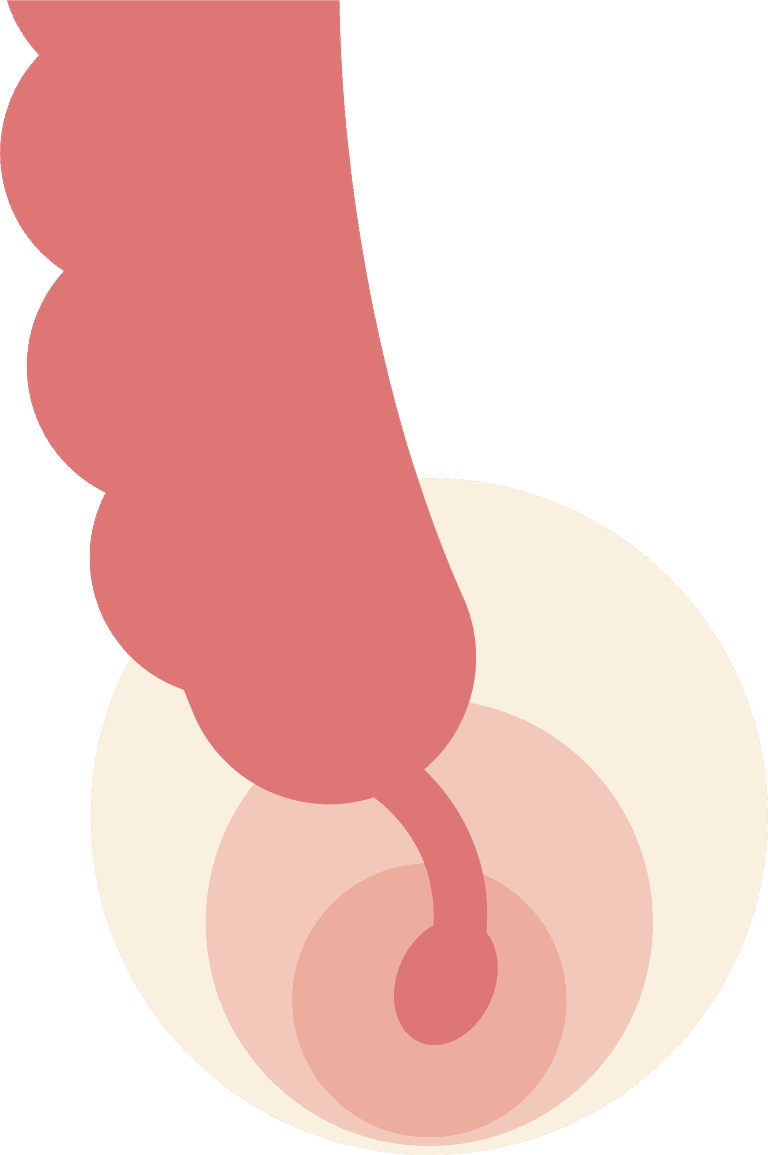 hemorrhoids digestive system icons set for health education and awareness