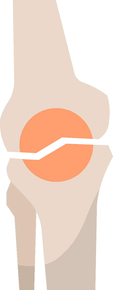 orthopedics color icons set for knee health and injury prevention in medical contexts