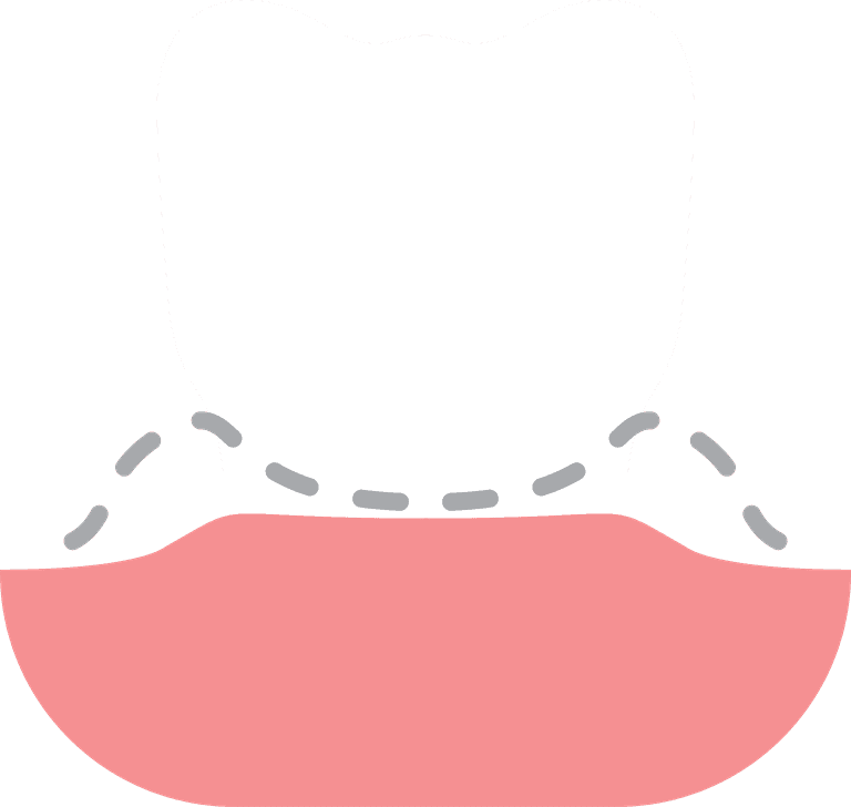 set dental problem implant icons flat style