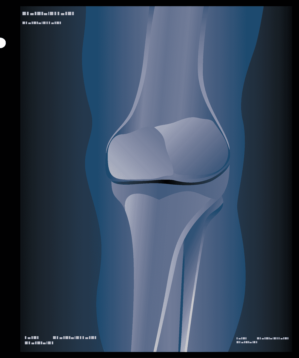 x ray film medical icons set
